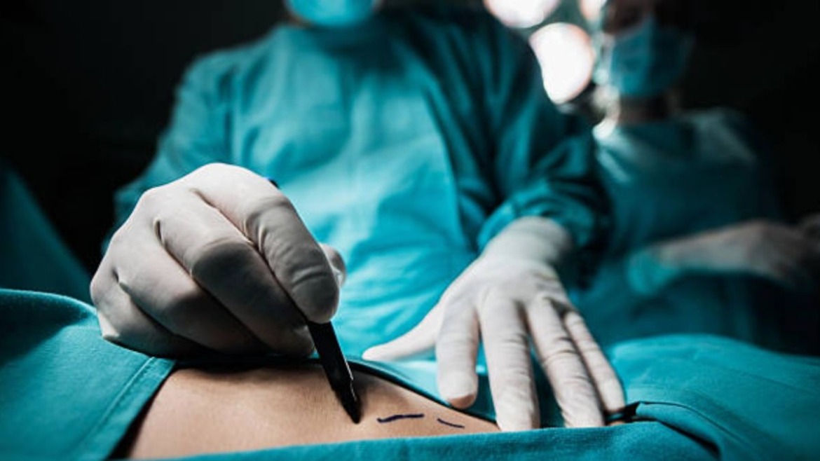 La ley exige que todo procedimiento sea realizado por un médico cirujano plástico certificado y en instalaciones con autorización sanitaria.