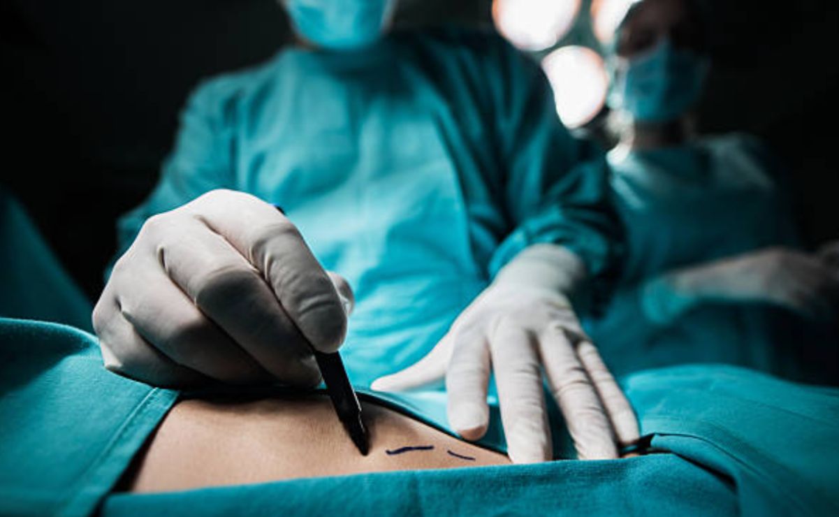 La ley exige que todo procedimiento sea realizado por un médico cirujano plástico certificado y en instalaciones con autorización sanitaria.